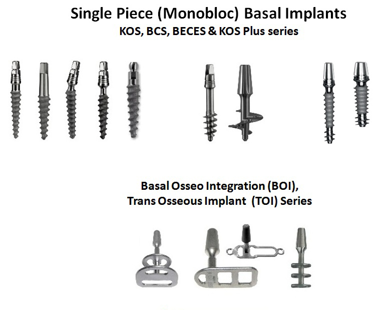 Basal Implants jalandhar punjab india
