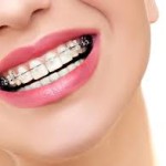 dental wiring braces jalandhar punjab India