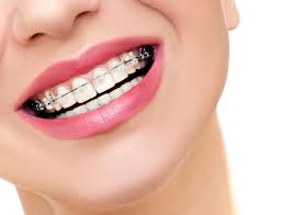  dental wiring braces jalandhar punjab India
